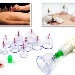 12 parça vakumlu hacamat kupa çekme seti